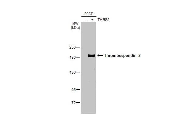 Thrombospondin-2 Antibody (HL1194) - Azide and BSA Free