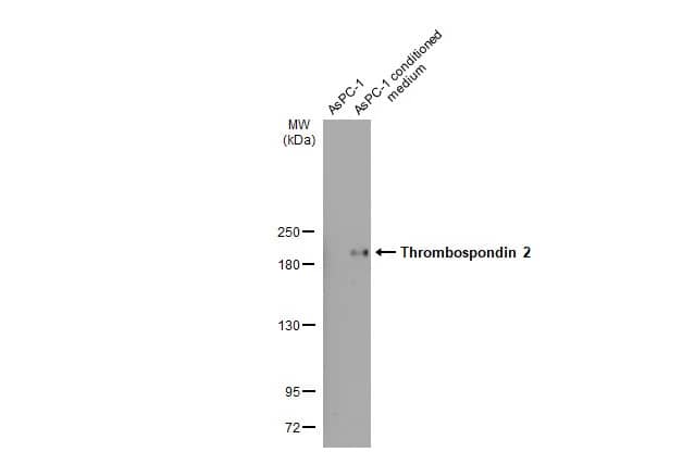 Thrombospondin-2 Antibody (HL1194) - Azide and BSA Free