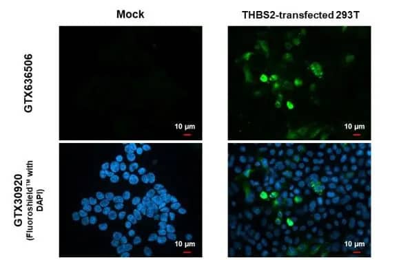 Thrombospondin-2 Antibody (HL1194) - Azide and BSA Free