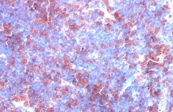 Thymidylate Synthase Antibody (HL1237) - Azide and BSA Free