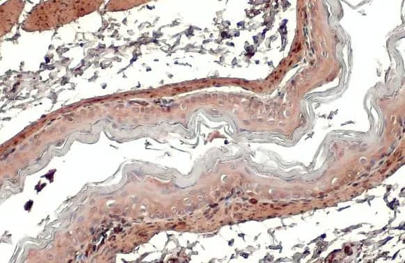 Transgelin/TAGLN/SM22 alpha Antibody (HL1270) - Azide and BSA Free
