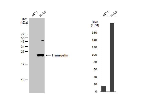 Transgelin/TAGLN/SM22 alpha Antibody (HL1270) - Azide and BSA Free