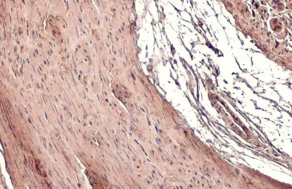 Transgelin/TAGLN/SM22 alpha Antibody (HL1270) - Azide and BSA Free