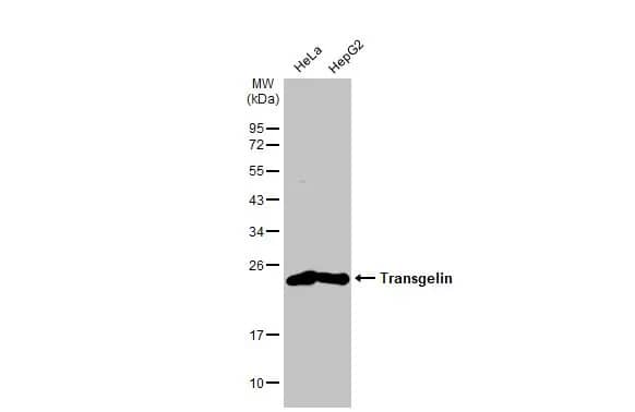 Transgelin/TAGLN/SM22 alpha Antibody (HL1270) - Azide and BSA Free