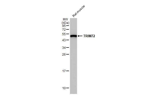 TRIM72 Antibody (HL1853) - Azide and BSA Free