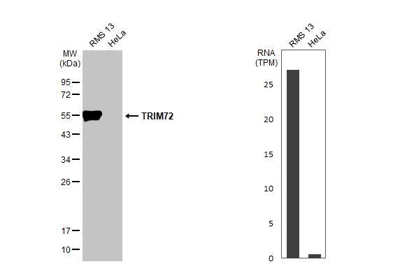 TRIM72 Antibody (HL1853) - Azide and BSA Free