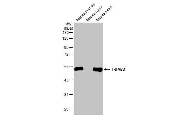 TRIM72 Antibody (HL1853) - Azide and BSA Free