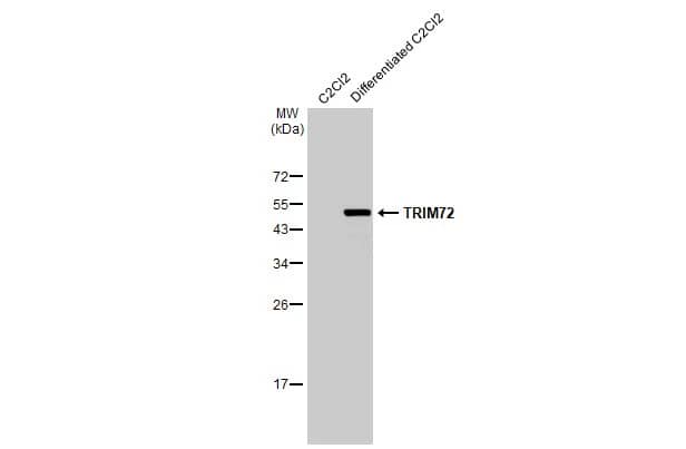 TRIM72 Antibody (HL1853) - Azide and BSA Free