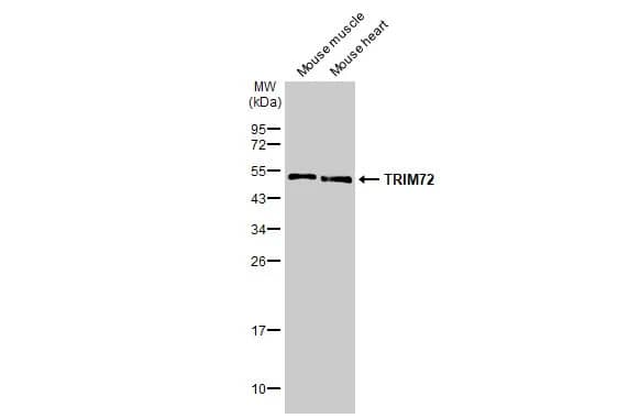 TRIM72 Antibody (HL1855) - Azide and BSA Free