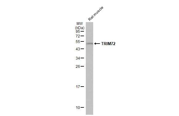 TRIM72 Antibody (HL1855) - Azide and BSA Free