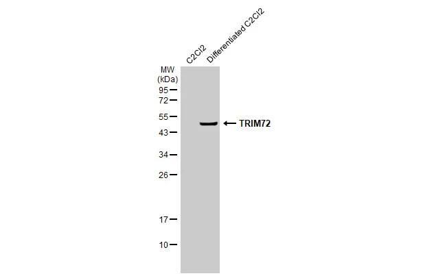 TRIM72 Antibody (HL1855) - Azide and BSA Free