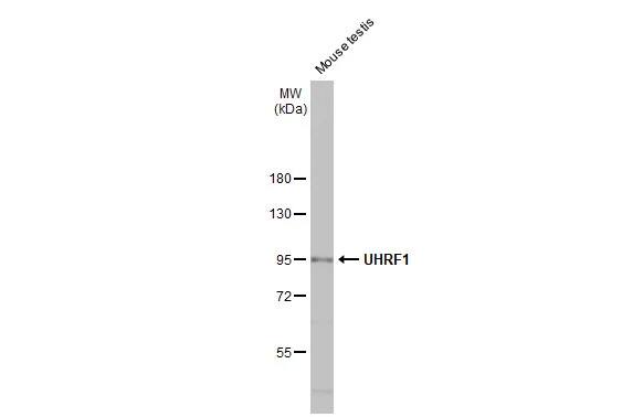 UHRF1 Antibody (HL2287) - Azide and BSA Free