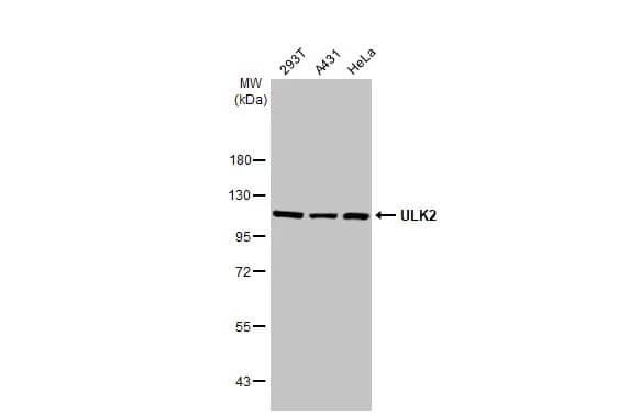 ULK2 Antibody (HL2206) - Azide and BSA Free