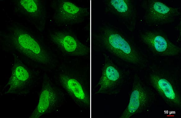 ULK2 Antibody (HL2206) - Azide and BSA Free