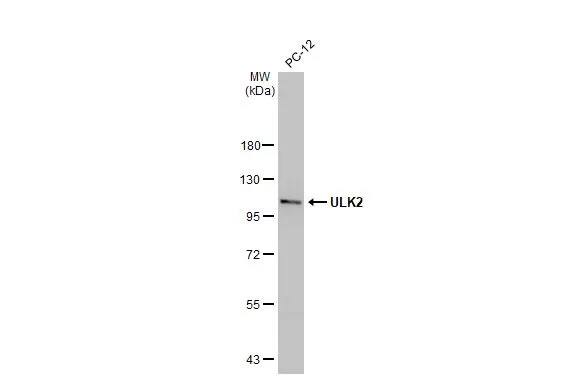 ULK2 Antibody (HL2206) - Azide and BSA Free