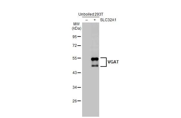 VIAAT/SLC32A1/VGAT Antibody (HL1616) - Azide and BSA Free