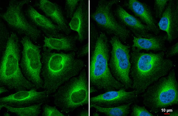 VPS34 Antibody (HL2305) - Azide and BSA Free