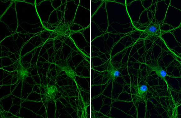 VRL1 Antibody (HL1543) - Azide and BSA Free