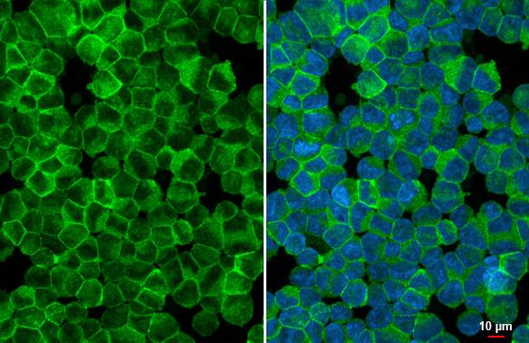 VRL1 Antibody (HL1543) - Azide and BSA Free