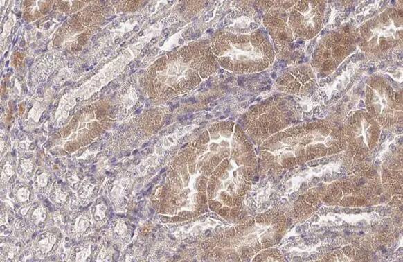 WNK1 Antibody (HL2184) - Azide and BSA Free