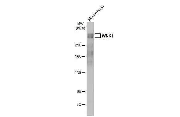 WNK1 Antibody (HL2184) - Azide and BSA Free