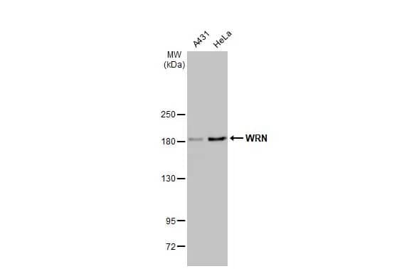 WRN Antibody (HL1729) - Azide and BSA Free