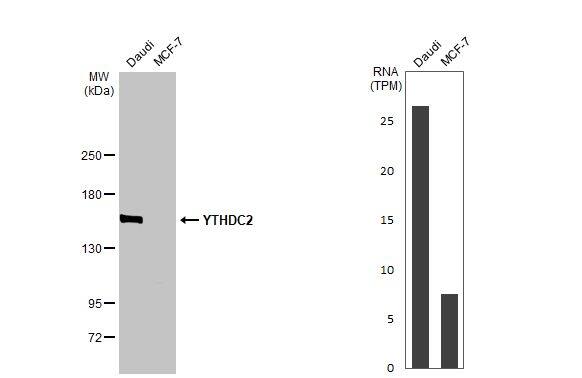 YTHDC2 Antibody (HL1861) - Azide and BSA Free