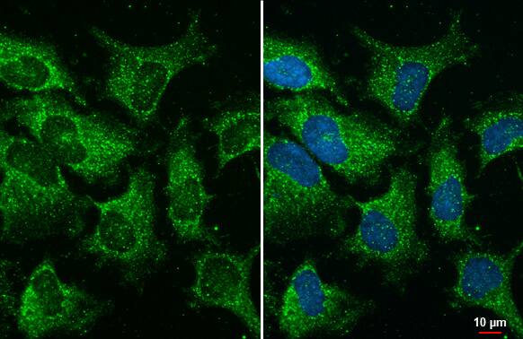 YTHDC2 Antibody (HL1862) - Azide and BSA Free