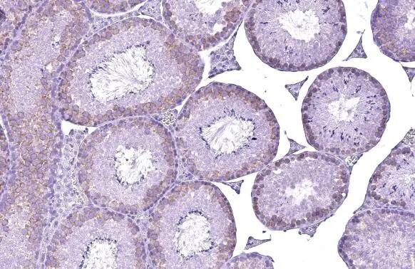 YTHDC2 Antibody (HL1862) - Azide and BSA Free