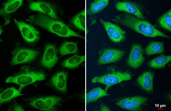 YTHDF2 Antibody (HL1355) - Azide and BSA Free