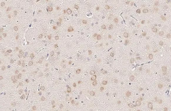 YTHDF3 Antibody (HL2235) - Azide and BSA Free