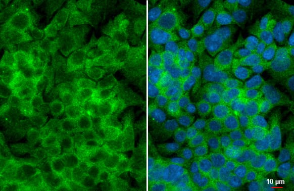 YTHDF3 Antibody (HL2235) - Azide and BSA Free