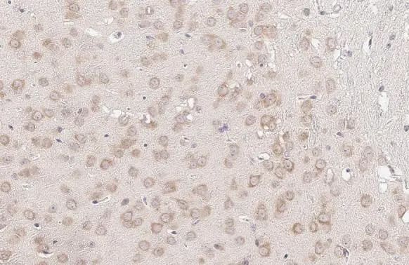 YTHDF3 Antibody (HL2235) - Azide and BSA Free