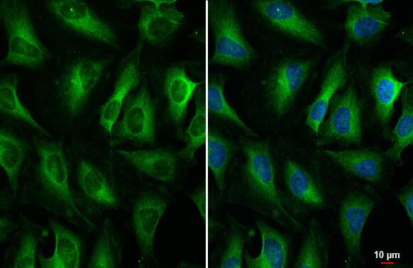 ZCCHV Antibody (HL1884) - Azide and BSA Free
