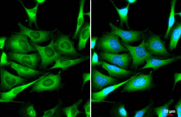 ZCCHV Antibody (HL1884) - Azide and BSA Free