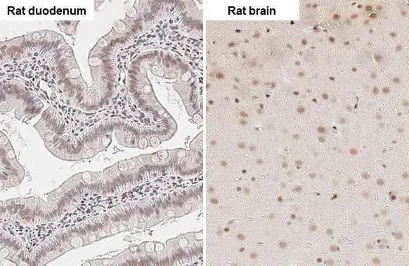 ZEB1 Antibody (HL2245) - Azide and BSA Free