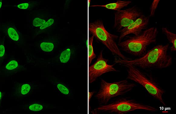 ZEB1 Antibody (HL2245) - Azide and BSA Free