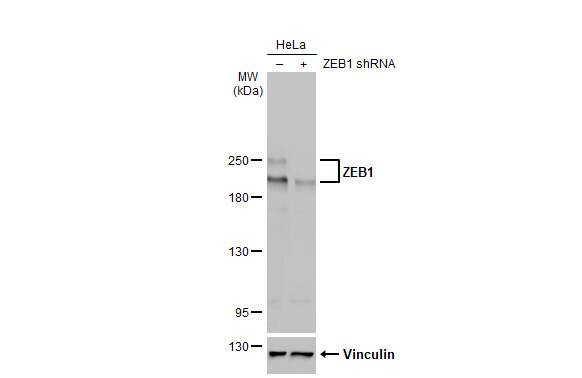 ZEB1 Antibody (HL2245) - Azide and BSA Free