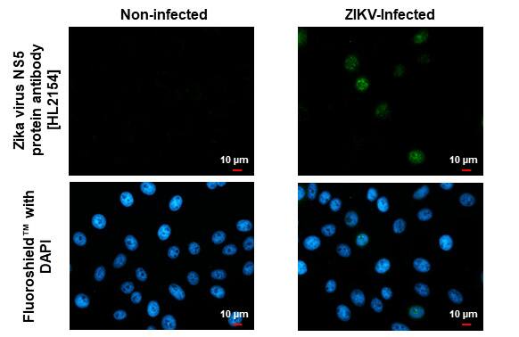 Zika virus NS5 Antibody (HL2154) - Azide and BSA Free