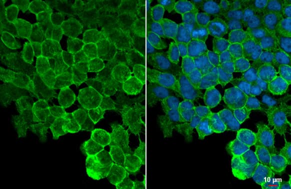 Tight Junction Protein 1 Antibody (HL1185) - Azide and BSA Free
