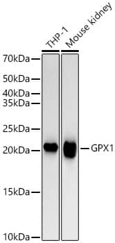 Glutathione Peroxidase 1/GPX1 Antibody (ARC53251)