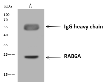 RAB6A Antibody