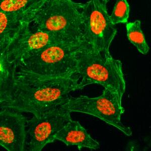 Histone H3 [ac Lys18] Antibody (RM166) - Azide and BSA Free