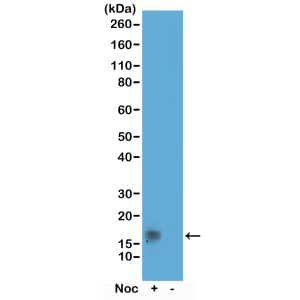 Histone H3 [p Thr11] Antibody (RM164) - Azide and BSA Free