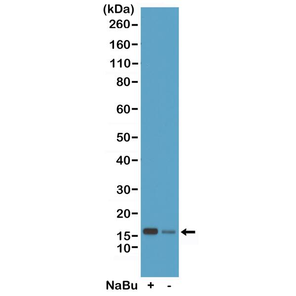 Histone H2B type 1B [ac Lys20] Antibody (RM235) - Azide and BSA Free