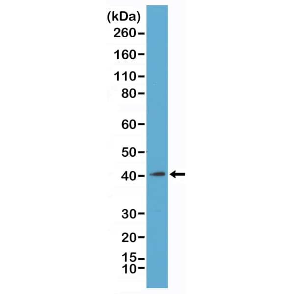 Histone H2AY/macroH2A.1 Antibody (RM248) - Azide and BSA Free