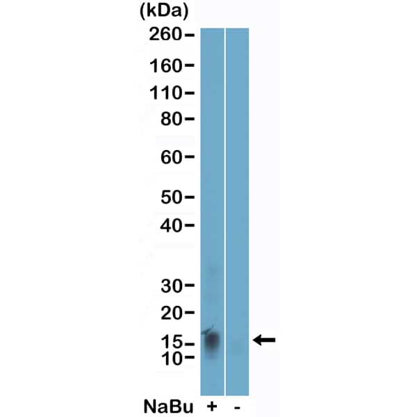 Histone H2B [ac Lys11] Antibody (RM456) - Azide and BSA Free