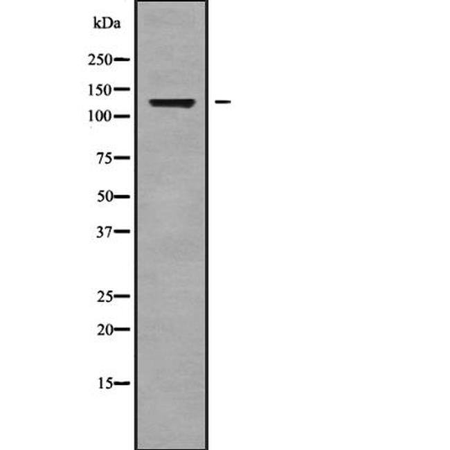 ADAMTS14 Antibody [Unconjugated]