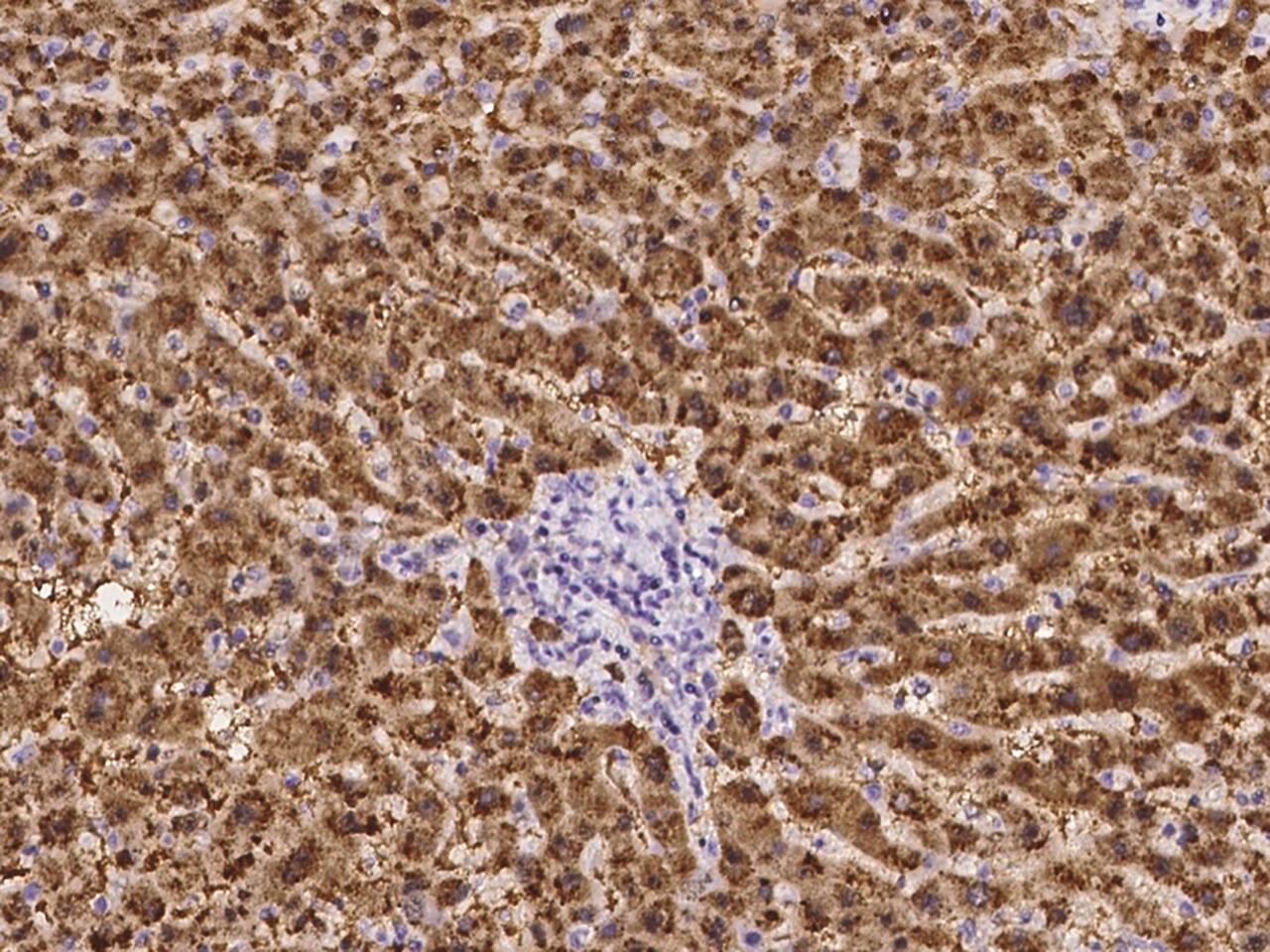 TTC38 Antibody - Azide and BSA Free
