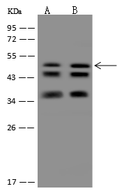 TTC38 Antibody - Azide and BSA Free